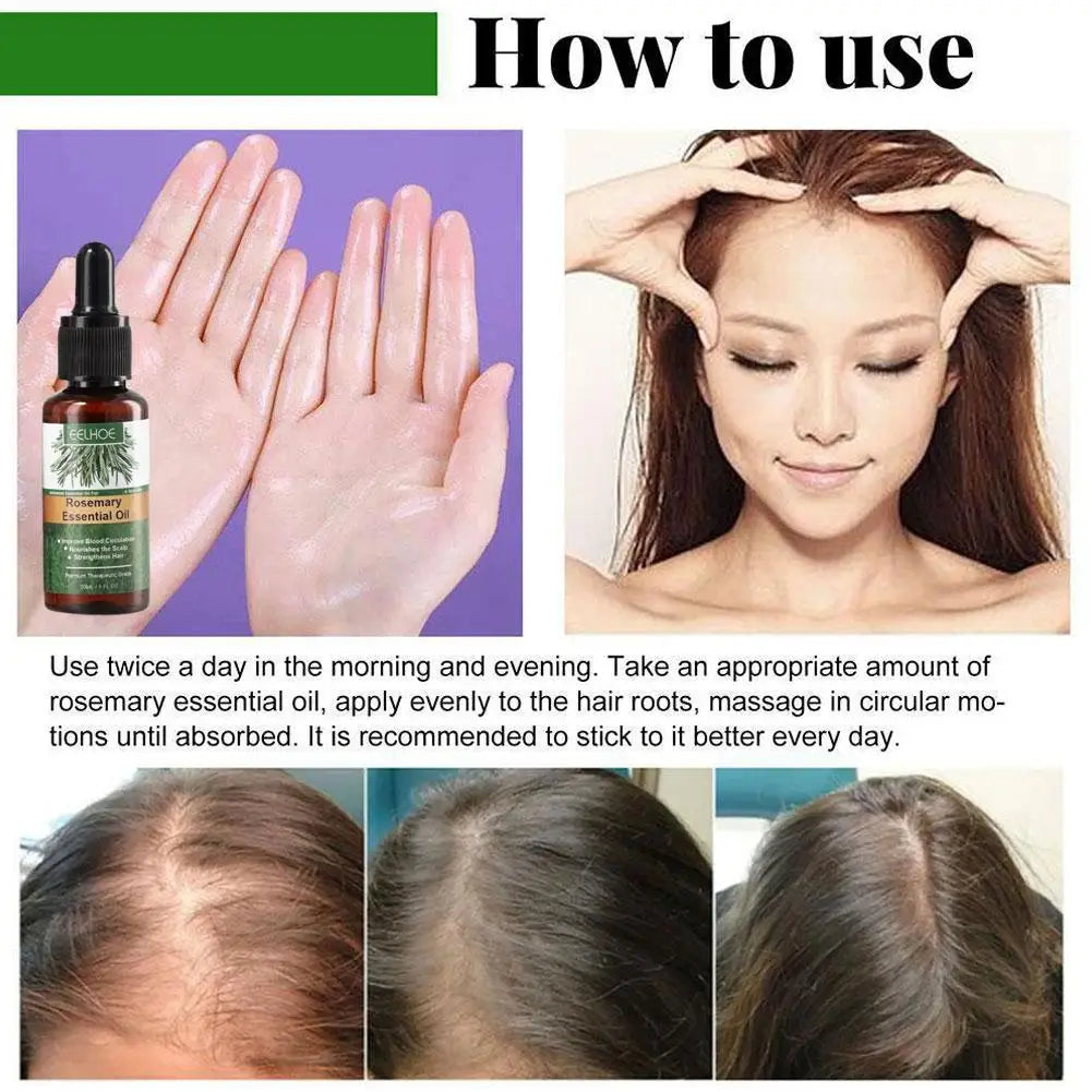 Essential Oil for Dry Scalp