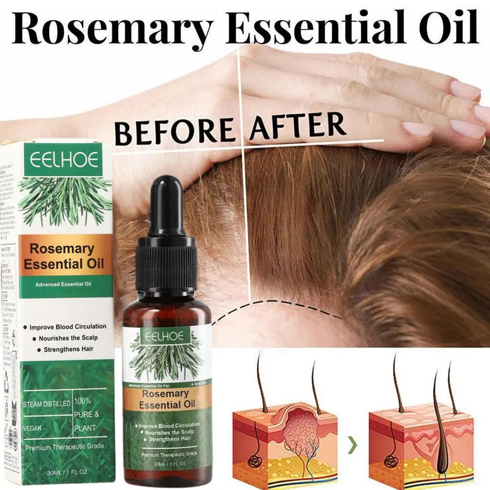 Essential Oil for Dry Scalp